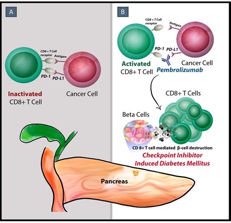 0di bets|Identification of Immune Checkpoint Inhibitor–Induced Diabetes.